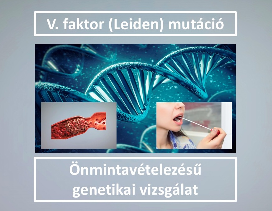 V. faktor (Leiden) mutáció vizsgálat